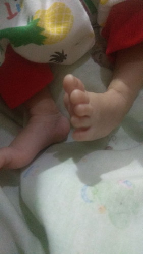 Kaki bayi di usia 20 harian apakah normal ?