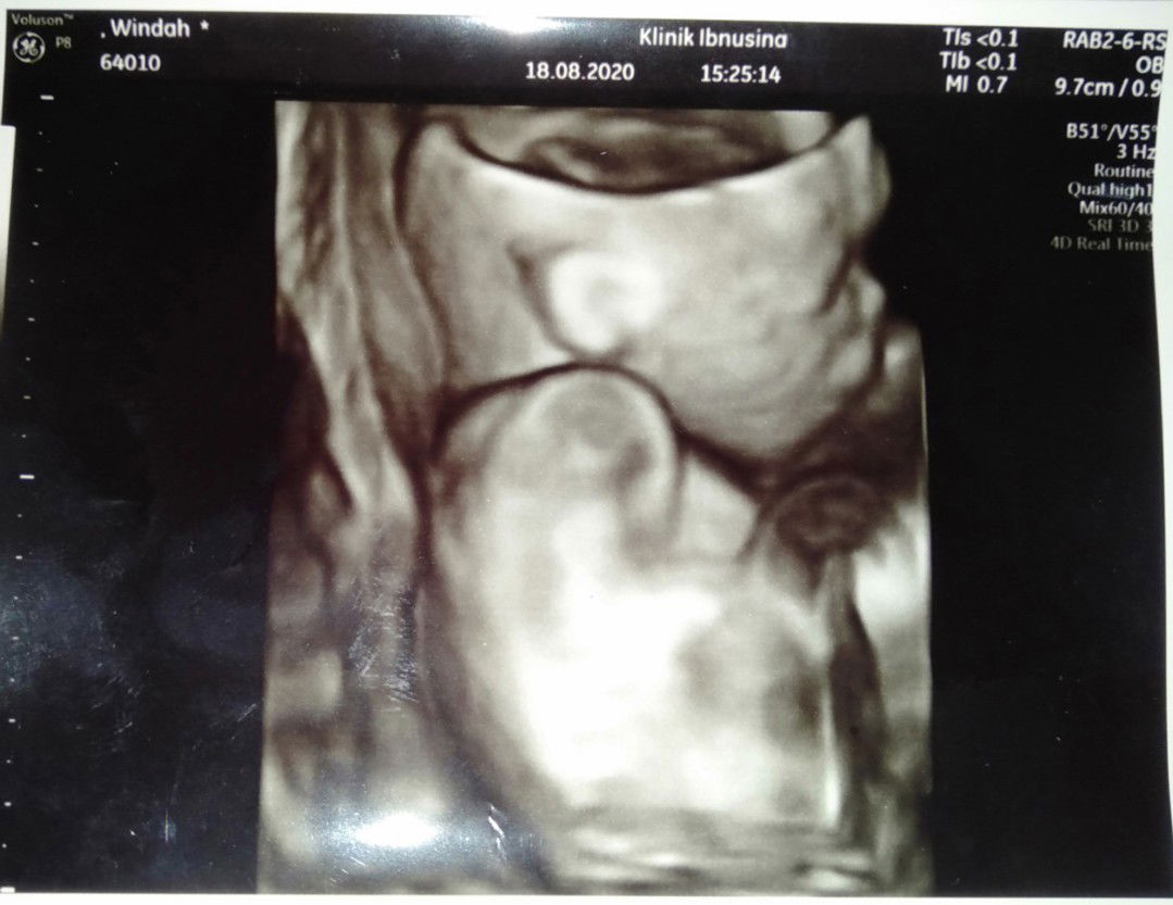 Qiana Hana Azzahra profile icon