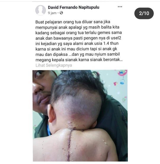 Jangan cium paksa bayi sembarangan