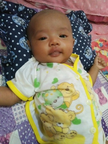 perut buncit. jarang bab