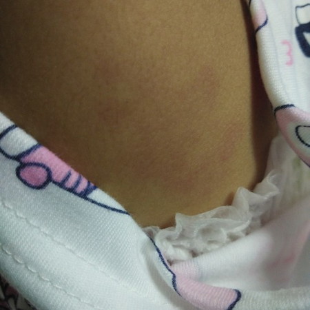 ทารก