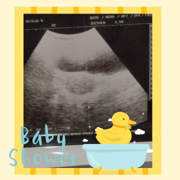 Saya hamil 7 weks, kenapa ngeflek warna pink kecoklatan gitu bun? Galau banget rasanya