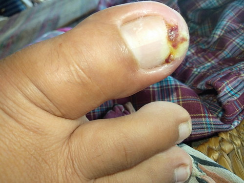 ยาสำหรับคนท้อง