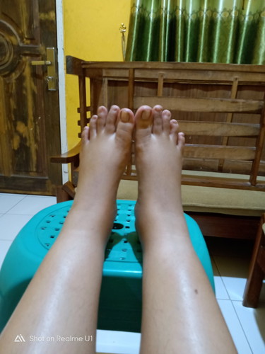 bengkak kaki