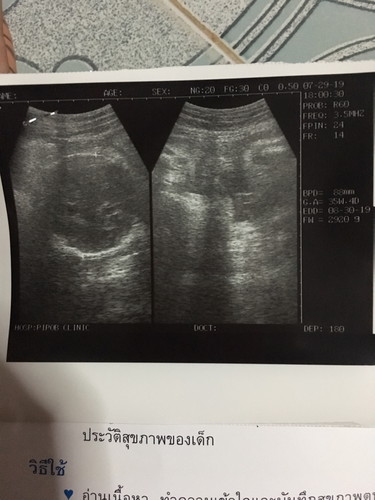 น้ำหนักลูก