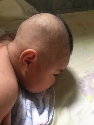 หัวทุย /หัวแบน ?