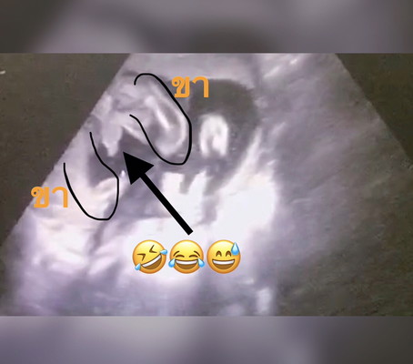 กำหนดคลอดเดือนตุลาคม❤️