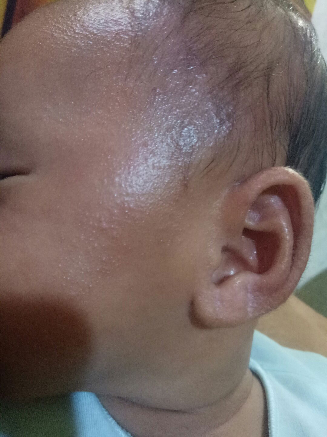 Bintik merah di sekitar wajah