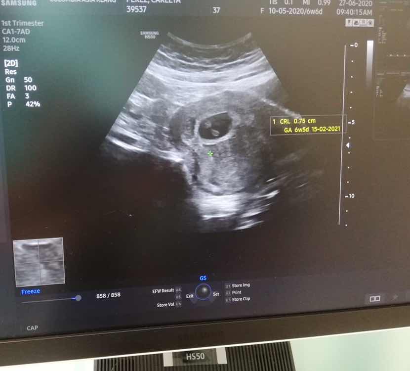 Teng Txt profile icon