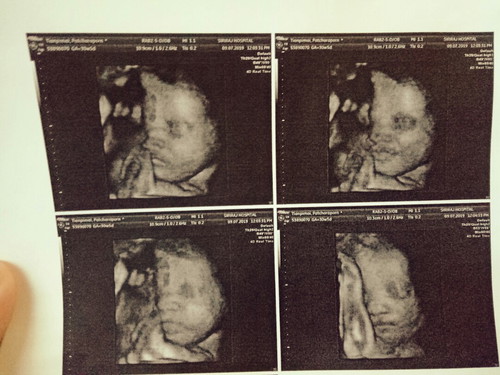 แอบกลัวลูกน้ำหนักน้อยเพราะแม่ต้องคุมอาหาร