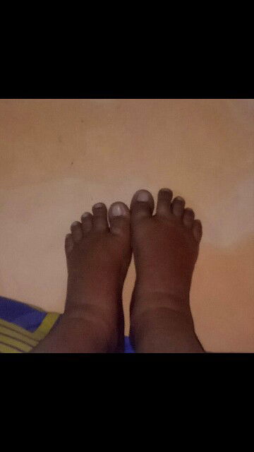 Kehamilan Pertamaku Yang Menakutkan