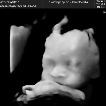 Shanty Sunarto profile icon