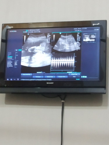 ππππππππππ