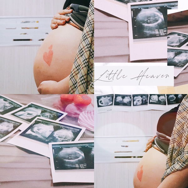 Anggi Zerlina profile icon