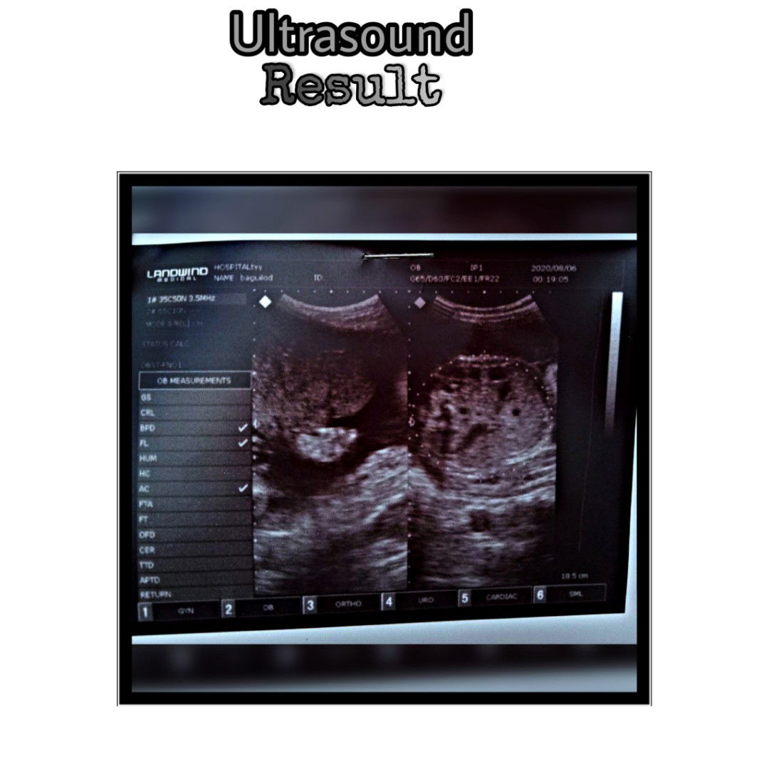 Joana Mae Conjurado Baguilod profile icon