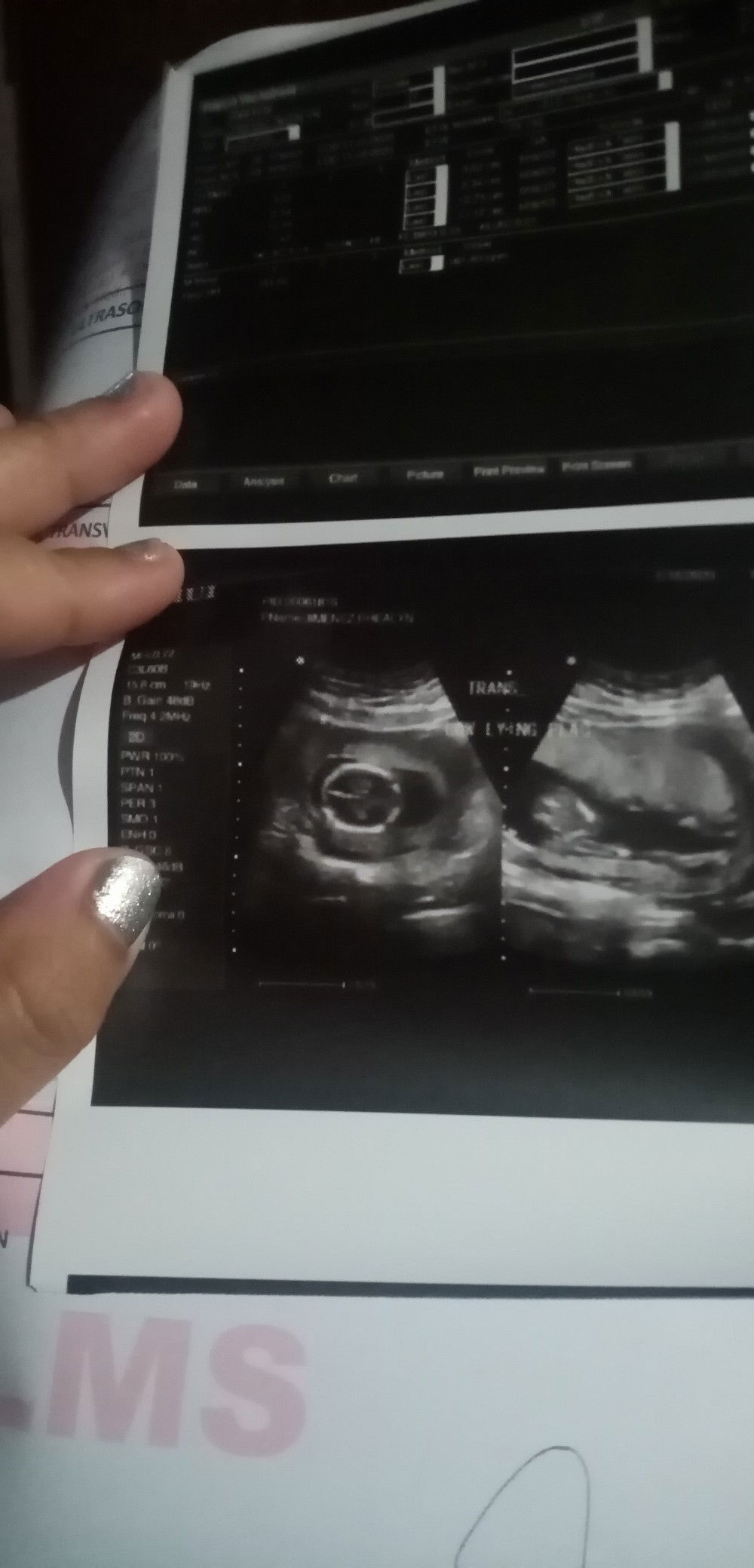 Eniar Aled Zurc Zenemij profile icon