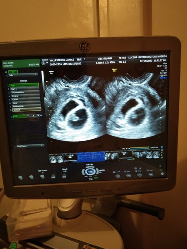 how can i check my another baby because its twin because the other is small..