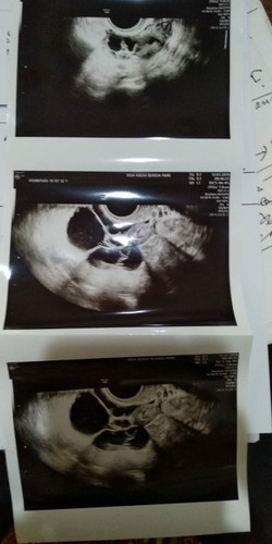 vonis dokter "hamil tanpa bayi tabung tdk akan mungkin"