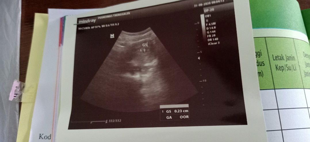 Adhita Ayu profile icon