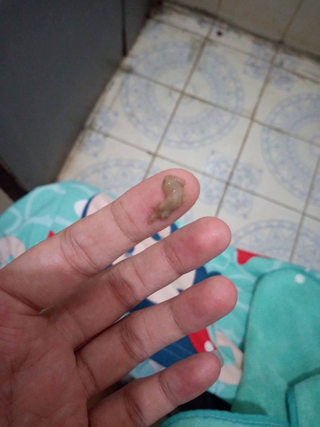 มีก้อนออกมาหลังตรวจภายใน