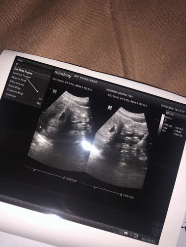 aku hamil kata dokter 4 minggu
nah sekarang gejalanya seperti orang masuk angin bingung mau minum obat apa🙁