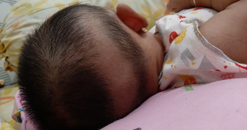 rambut bayi tidak tumbuh rata (bantal'en)