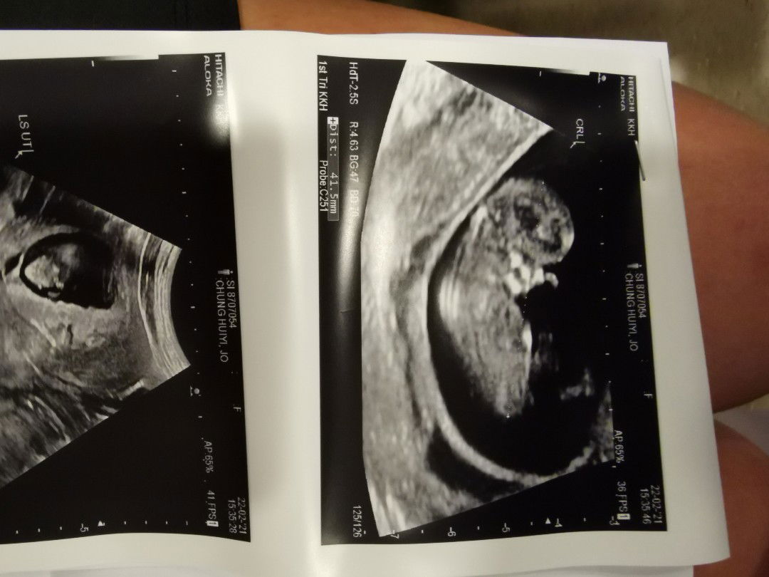 God's gift profile icon