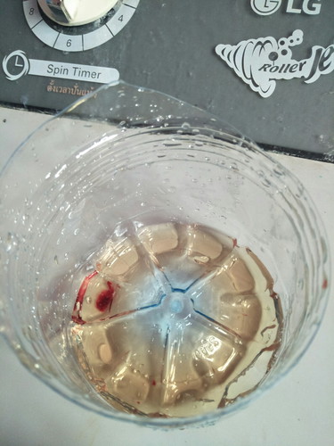 กระเพาะปัสสาวะอักเสบ