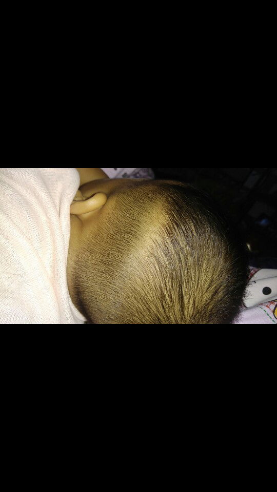 Rambut Tumbuh Gak Rata