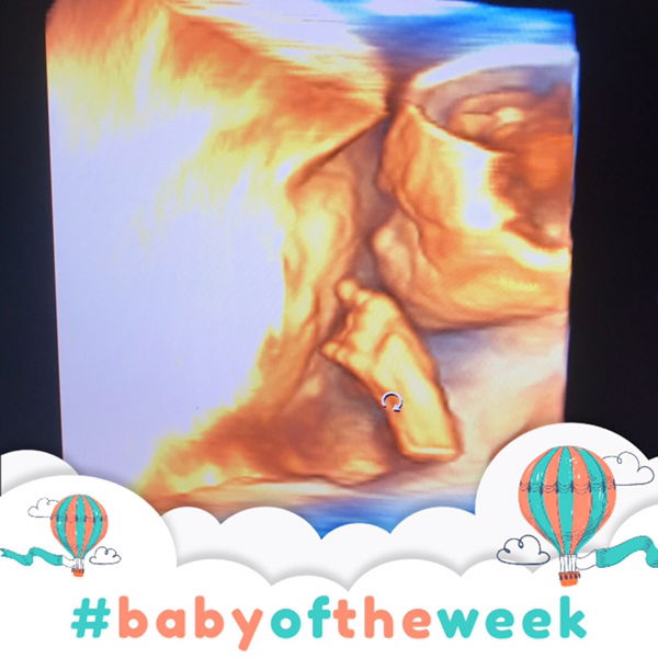 Chantika Kharisma Dewi profile icon