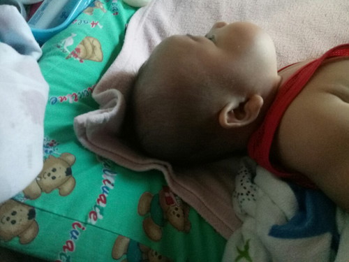 ลูกหัวเเบน