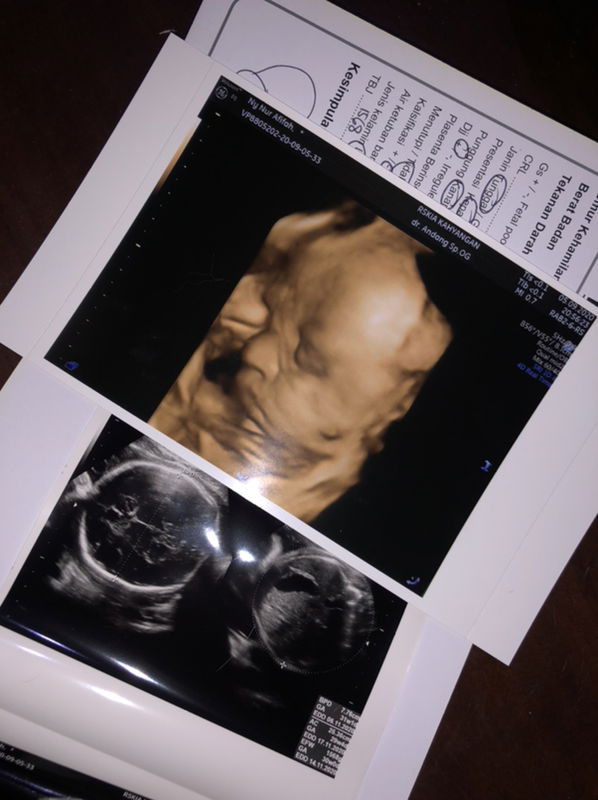 Afifa Skuzinskas profile icon