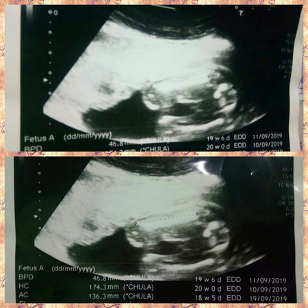 เพศลูก