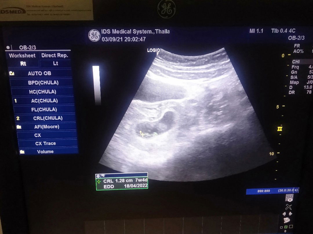 Supaksorn Khadlok profile icon