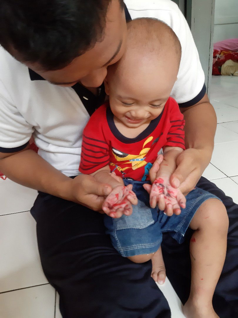 agar rambut anak cepat tumbuh