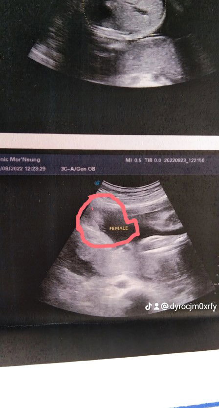 แนน จร้า profile icon