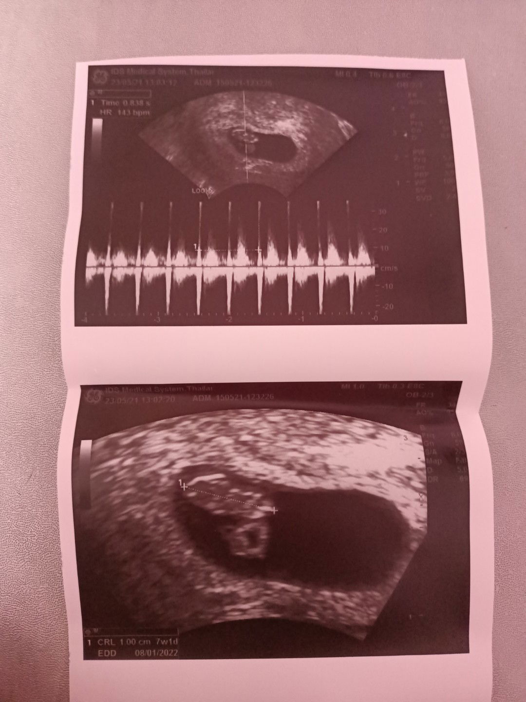 Lukkeaw Lukkeaw profile icon