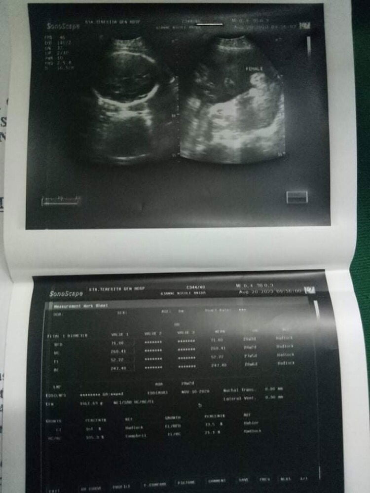 Humy Pagpaguitan profile icon