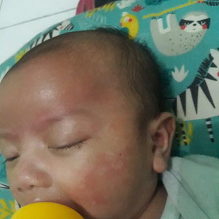 muka bayi merah