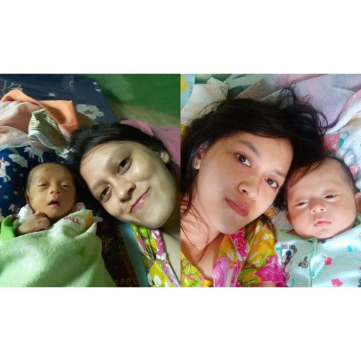 Merawat Bayi Prematur