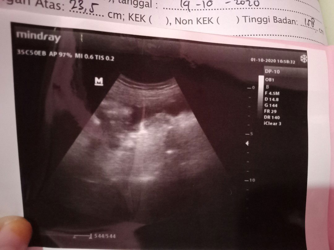 Wika Saridevii profile icon