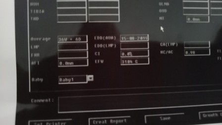 เจ็บท้อง