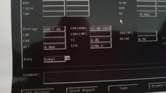 เจ็บท้อง