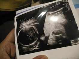 ผลซาวน์ลูก