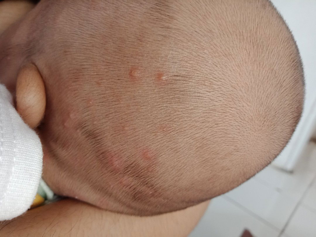 bintik putih kemerahan