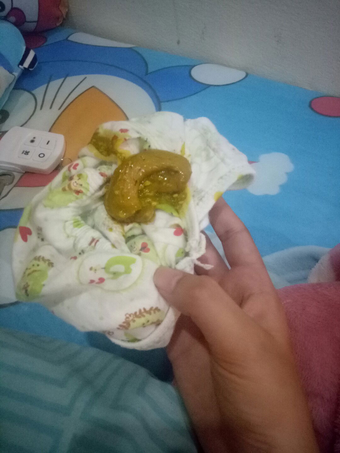 แม่คะคือน้องถ่ายแบบนี้ปกติไหมคะเหมือนมันเหลวๆเป็ยก้อนๆนะคะน้องทานข้าวได้1อาทิตแล้วเพราะหมอบอกทานได้แล้วคะน้อง5เดือน15วันคะ #รูปใต้คอมเม้นนะคะ