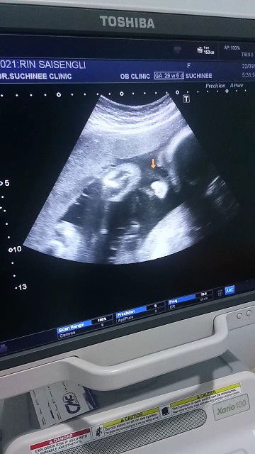 แฮ็กเล่อ หําหด profile icon