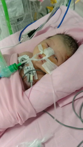 bayi baru lahir terkena infeksi paru-paru apakah bisa sembuh?