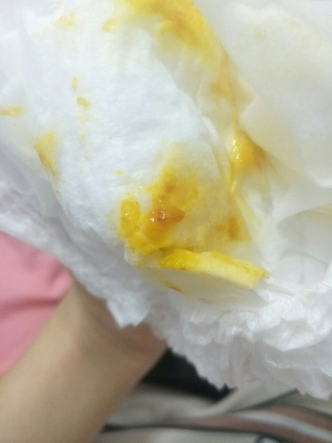 ลูกทานอาหารมื้อแรกตอนเย็นค่ะ เป็นข้าวสวยปั่นผสมนมแม่ หลังจากนั้นมีถ่าย3 ครั้ง 2 ครั้งแรกปกติ  ถ่ายครั้งที่3 ไม่เยอะ แต่มีมูกเลือดเล็กน้อย