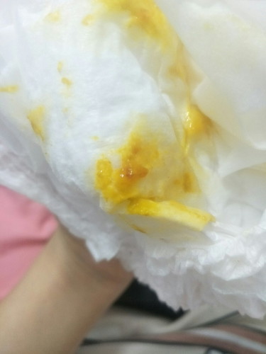 ลูกทานอาหารมื้อแรกตอนเย็นค่ะ เป็นข้าวสวยปั่นผสมนมแม่ หลังจากนั้นมีถ่าย3 ครั้ง 2 ครั้งแรกปกติ ถ่ายครั้งที่3 ไม่เยอะ แต่มีมูกเลือดเล็กน้อย